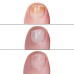  Treatment 4-piece Nail Set